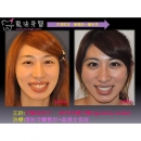 脸变小 - Dental Orthodontic-11