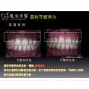 牙龈美白 - Dental Esthetics-2