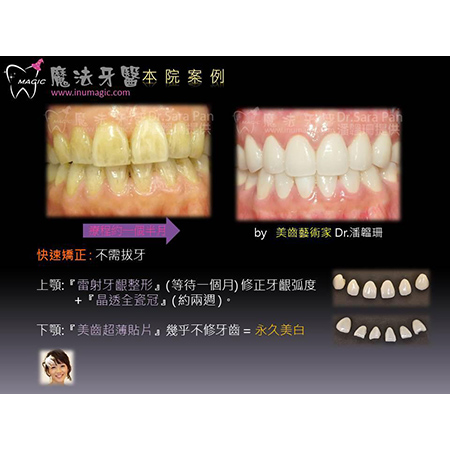 3D齿雕 - Dental Esthetics-8