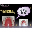 舌侧矫正 - Dental Orthodontic-5