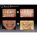 正颚手术 - Dental Orthodontic-8