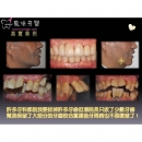 植牙医生 - Dental Implants-10