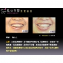 牙科中心 - Dental Implants-2