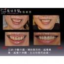 暴牙 - Dental Orthodontic-7