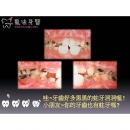 儿童矫正牙齿 - Children Dental-1