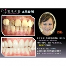 微笑曲线 - Dental Esthetics-4