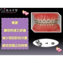 矫正 - Dental Orthodontic-6