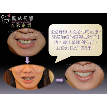 脊椎侧弯 - Dental Orthodontic-9